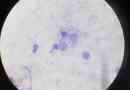 Vilka är de mest endemiska områdena för hundar leishmaniasis
