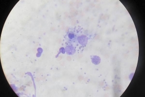 Vilka är de mest endemiska områdena för hundar leishmaniasis
